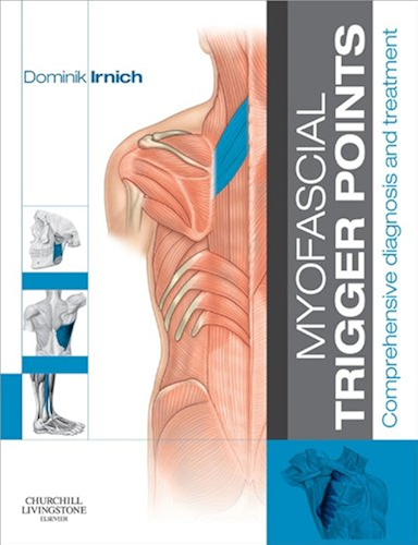 Download Myofascial Trigger Points - E-Book: Comprehensive diagnosis and treatment (English Edition) PDF