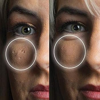 scar cover up makeup