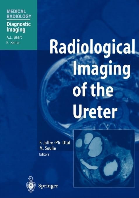 Radiological Imaging of the Ureter: Iron Centres (Medical Radiology / Diagnostic Imaging)