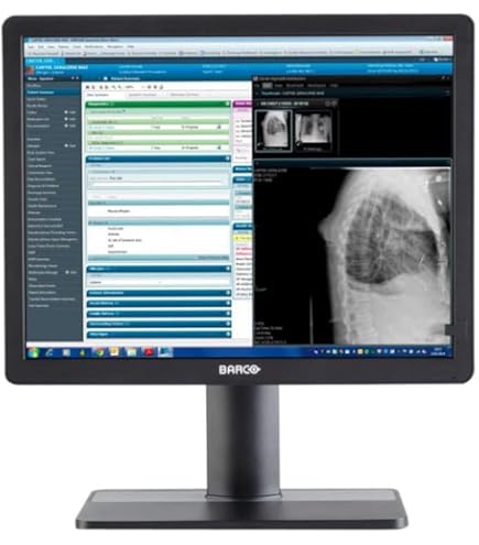 Amazon.com: Eizo FlexScan S2133-BK 21.3