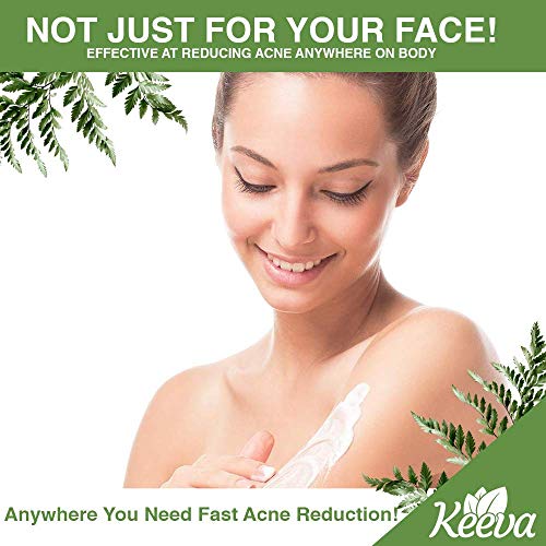 Keeva Organics Acne Treatment Cream With Secret TEA TREE OIL Formula - Perfect For Acne Scar Removal, Fighting Breakouts, Spots, Cystic Acne - See Results in Days Without Dry Skin (6oz)