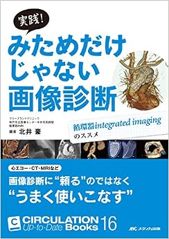 本の実践! みためだけじゃない画像診断: 循環器integrated imagingのススメ (CIRCULATION Up-to-Date Books 16) (日本語) 単行本 – 2016/9/27の表紙