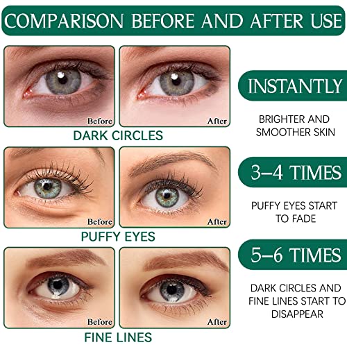 Eye Pads, 60 Pieces Eye Pads, Collagen Eye Pads Against Dark Circles with Aloe Vera, Hyaluronic Acid Eye Mask, Dark Circles Removal, Wrinkles, Eye Bags, Puffiness (Green)