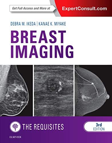 Diagnostic Breast Imaging 第2版 Making the Diagnosis: A Practical Guide to Breast Imaging: Expert