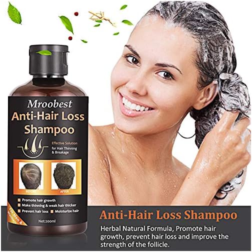 Anti Hair Loss Shampoo Hair Regrowth Shampoo Natural Old Ginger