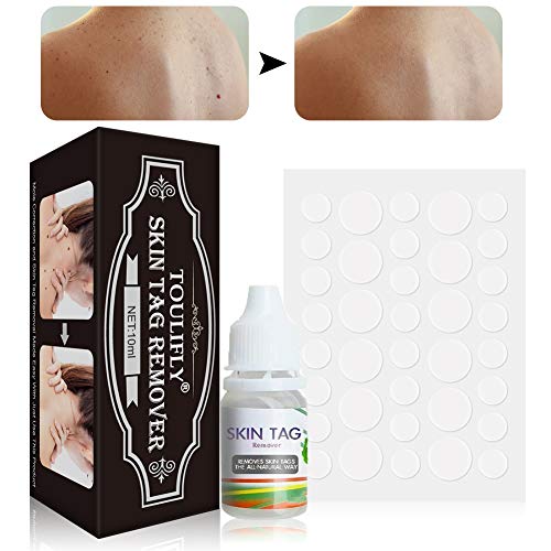 Skin Tag Remover Patches, Mole Remover, Skin Tag Removal