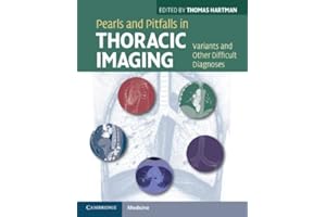 Pearls and Pitfalls in Thoracic Imaging: Variants and Other Difficult Diagnoses