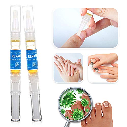 St. Mege, Fungus Stop Fungus Nail Repair Pen 4 Pens included,Natural Fungal Nail Care Solution for Fingernails and Toenails, Perfect for Strengthening Unhealthy Nails        