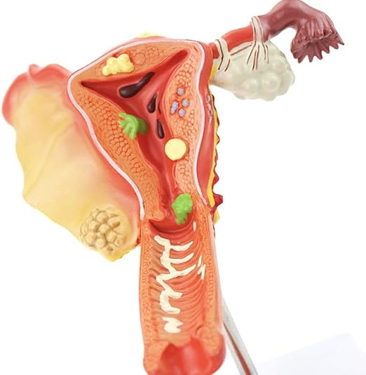 Amazon Co Jp 人間の解剖学的モデル 人間の解剖学的モデル Medical子宮 卵巣 膣 解剖学モデルツール子宮 卵巣の研究材料pvc ホーム キッチン