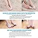 Fittest Pro Toe & Bunion Relief Package - Toe Straightener, Separator, Spreader, Corrector, Protector, Spacer, Stretcher - Bunion Corrector, Shield, Support, Cushions, Bootie (Pack of 15)