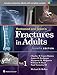 Rockwood and Green's Fractures in Adults (Fractures in Adults (Rockwood and Green's))