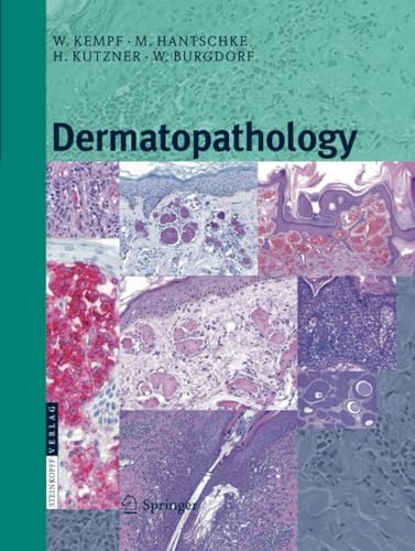 Lever's Histopathology of the Skin 第10版 Histopathology of the skin: Walter F. Lever: 9780397520954: Amazon