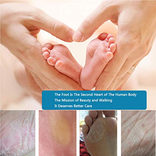 VÉZAAR Foot Dead Skin Pusher Pedicure Foot File Massager, Calluses Remover, Colossal Feet Rasp Care Professional Foot SPA Tool for Cracked Corns Cuticle Hard Skin, Stainless Steel Coarse Gift Files - Thumbnail 6