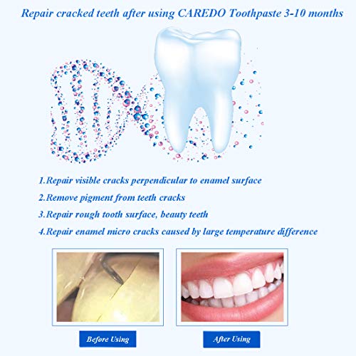 CAREDO Healing Teeth Crack Toothpaste, The ONLY Toothpaste Repairing