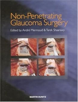 Non Penetrating Glaucoma Surgery Kindle Edition By Tarek