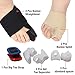 Bunion Corrector, 9 pcs Bunion Corrector and Bunion Relief, Bunion Night Splint with Super Soft Gel for Foot Pain Relief, Hallux Valgus Splint Aid Surgery Treatment Toe Separators Straighteners