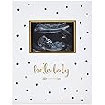 Pearhead Sonogram Baby Memory Book - Black & Gold Polka Dot, Includes 50 Guided Pages & Photo Spots