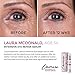 Intensive Eye Serum for Dark Circles, Puffiness & Bags Under Eyes with Collagen & Retinol – Anti Aging & Anti Wrinkle Under Eye Gelthumb 3