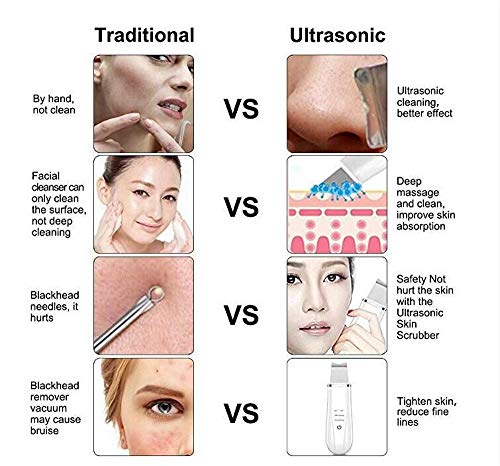 Skin Scrubber Spatula Ultrasonic, Blackhead Remover Exfoliator Pore Cleaner Kit, Skin Care Facial Cleansing Tool, Gift Set for Women - Thumbnail 5