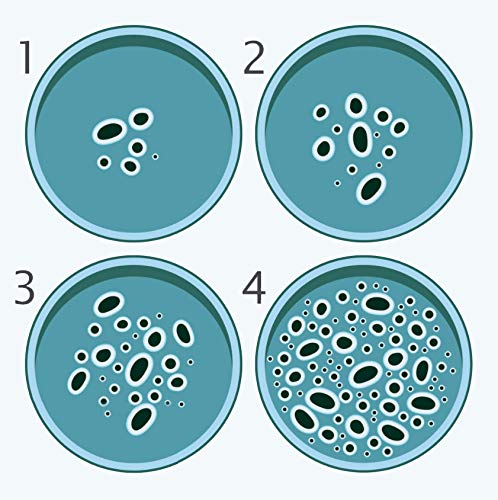 Onnetila Bacteria Science Kit Petri Dishes with Agar Educational STEM Science Fair Project Kit for Kids Age 9 and Above