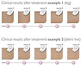 Philips Norelco SC1981/50