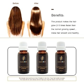 Buy Sunburst Hair Growth Products Upgraded Andrea Hair Growth