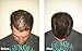 Hair Building Fibers for Balding Hair (22g / Large Bottle) - Instant Hair Thickening Fibers for Thinning Hair - Discreetly Cover Bald Spots by grace and stella (Blond)
