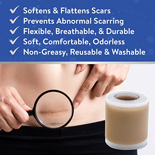 Aroamas Scar Silicone Scar Sheets Silicone Scar Tape 1.6x60 for