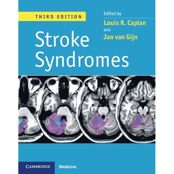 Amazon.com: Stroke Syndromes eBook : Caplan, Louis R., Caplan