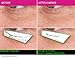 Venin Royale - Snake Venom Anti-Aging and Anti-Wrinkle Peptide Serum for Fine Lines, Rosacea, Uneven Tone | Best Skin Care for Face, Hands & Neck | Neuropeptide Treatment & Botox Cream (1.7oz)