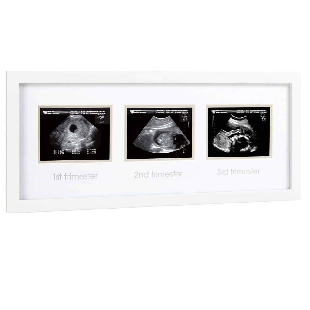 Pearhead Triple Sonogram Pregnancy Frame, Baby Scan Photo Frame, Pregnancy Announcement, White
