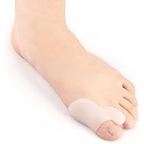 Insoles for hallux valgus Clearance