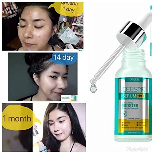 Qeesna Serum Vit C Whitening Booster For Freckles Scars Melasma Dark Spot Amazon In Beauty