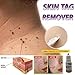 Dolnfin Strength Skin Tag Remover Foot Treatment Mole Skin Tag Body Warts Remover Athletes Foot Remediesthumb 1