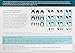 Hairmax Professional 12 Lasercomb