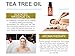 Tea Tree Oil by AromaOils - Pure Therapeutic Grade Melaleuca Oil - 1 fl oz (30 ml) - Best for Skin Tag Removal, Nail Fungus Treatment, Aromatherapy, Scented Massage Oil, Acne Reducer, Facial Toner (Package may vary)