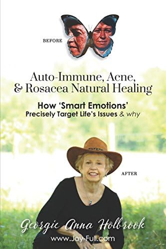 Auto-Immune, Acne, & Rosacea Natural Healing - How 'Smart Emotions' Precisely Target Life's Issues & Why