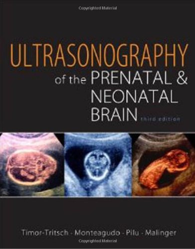 ULTRASONOGRAPHY OF THE PRENATAL & NEONATAL BRAIN