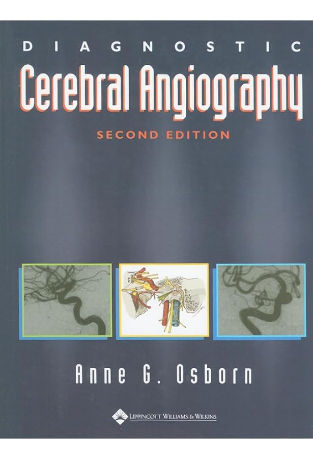Decision Making in Neurovascular Disease: 9781684200573: Medicine