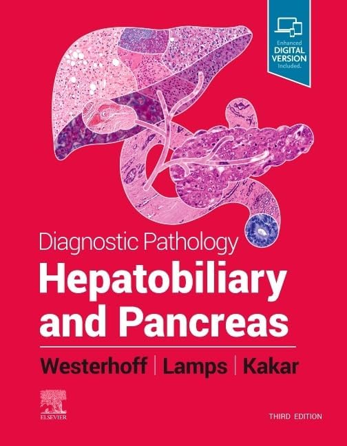 Diagnostic Pathology: Kidney Diseases: 9780323661089: Medicine
