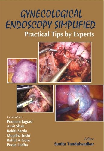 GYNECOLOGICAL ENDOSCOPY SIMPLIFIED: PRACTICAL TIPS BY EXPERTS