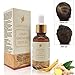 Hair Growth Serum,Hair Growth Treatment,Hair Serum,Hair Loss &Hair Thinning Treatment, Hair Growth Oil for Stronger, Thicker, Longer Hair(30ml)thumb 1