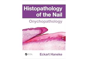 Histopathology of the Nail: Onychopathology