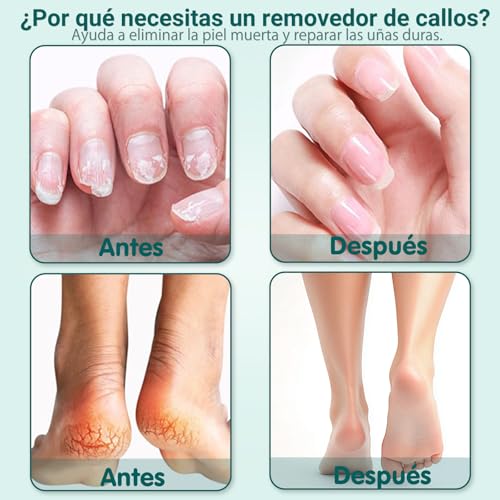 Lima Para Pies Electrica, Removedor de Callos Para Pies ajustables de 15 velocidades con pantalla LED, lima para uñas pies 2 en 1, lima electrica pedicure para pies recargable de 2000 mAh para piel muerta y uñas gruesas