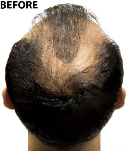 Super Million Hair - 1 x 25g Hair Building Fibres - No.5 Ash Blonde, 25g Medium Blonde No:5, 25 g (Pack of 1) - Image 5