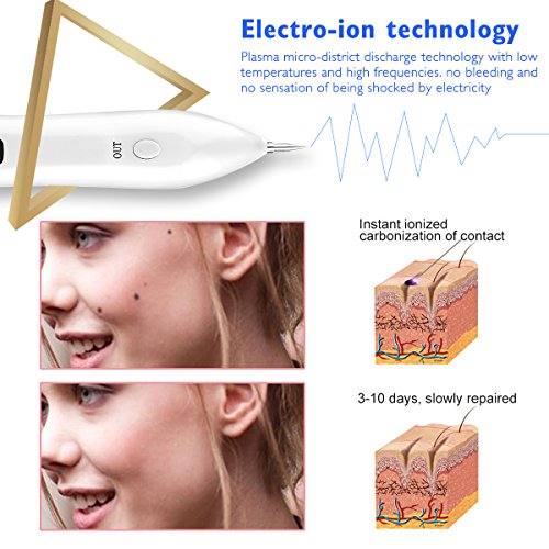 Mole Remover Pen, Skin Vanish Tag Removal Tool Kit with USB Rechargeable 9 Strength Levels, Portable Professional Beauty Spot Dot Device for Body Facial Freckle Nevus Warts AgeTattoo Blemish Men Women - Thumbnail 2