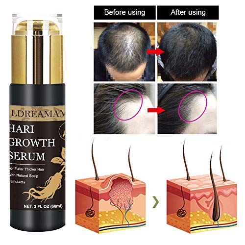 Hair Growth Serum, Anti-Hair Loss Serum, Strengthen Hair Roots Thickening, Promote Hair Growth Regrowth Product for Men and Women  - Thumbnail 3