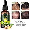 2 Pack MS.DEAR Newly UPGRADED Hair Growth Serum Anti Hair Loss Essence, Natural Herbal Essence for Bald, Thin Hair, Fast…