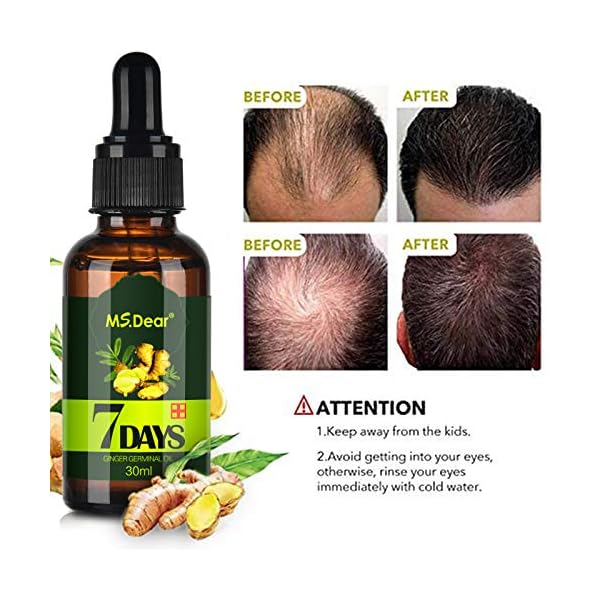2 Pack MS.DEAR Newly UPGRADED Hair Growth Serum Anti Hair Loss Essence, Natural Herbal Essence for Bald, Thin Hair, Fast…
