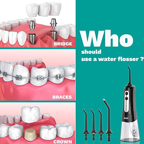 Topyet Water Flossers for Teeth,Gums, Braces Flossers with 4 Tips